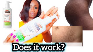 Palmers Cocoa Butter Stretch Marks Removal Cream Review Get Rid Of Your Stretch Marks Permanently [upl. by Cilo911]