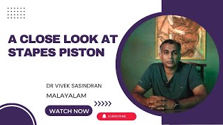 Understanding the Stapes Piston Treatment for Otosclerosis  Malayalam  Dr Vivek Sasindran [upl. by Kessel]