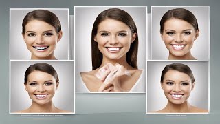 Transform Your Smile with Dental Veneers  How Do They Work and Why Are They So Popular [upl. by Anerual844]