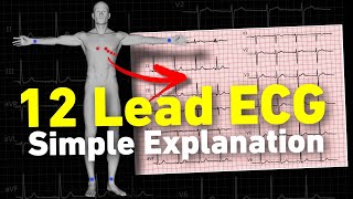 12 lead ECG  ECG interpretation made easy • Daily Cardiology [upl. by Stiles]