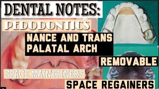 NANCE PALATAL ARCH II TRANS PALATAL ARCH II REMOVABLE SPACE MAINTAINERS II SPACE REGAINERS II easy [upl. by Ramoj]