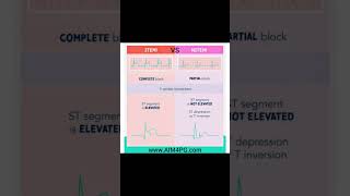 STEMI vs NSTEMI [upl. by Siravart]