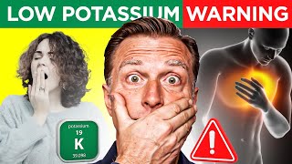 The Low Potassium Epidemic Dr Berg Explains Symptoms Signs Diet Causes and Treatment [upl. by Fredela]