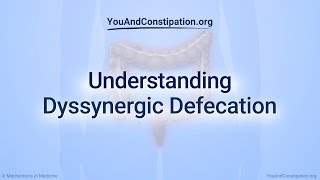 Understanding Dyssynergic Defecation [upl. by Lelah356]