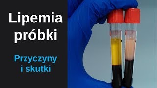 Lipemia zmętnienie próbki Co znaczy surowica lipemiczna  Lipemia turbidity sample lipemic serum [upl. by Ainesy]