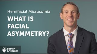 Hemifacial Microsomia Facial Asymmetry and Treatment Options  Boston Childrens Hospital [upl. by Geminian]