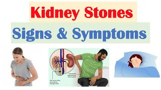 Kidney Stones Nephrolithiasis Signs amp Symptoms  amp Why They Occur [upl. by Catlin]