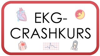 EKG Crashkurs  Auswerten in unter 10 Minuten AVBlock Vorhofflimmern STEMI Perikarditis [upl. by Tiphanie]