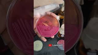 Macconkey agar biologycultureplate microbiology science MAC tjbiologist medicalfield love [upl. by Tavis]