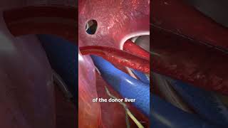 How Liver Transplants Work [upl. by Shaner]