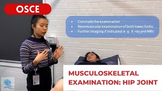 OSCE Video Series Musculoskeletal Examination Hip Joint  Teaching for Impact [upl. by Almira]