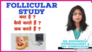 Follicular Study क्या होती है Hindi  Dr Khushboo  Mannat IVF Patna [upl. by Lilak217]