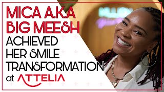 THE RISING STAR OF BRITISH TV MICA ACHIEVED HER SMILE TRANSFORMATION AT ATTELIA [upl. by Warfield]