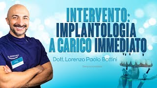 INTERVENTO DI IMPLANTOLOGIA A CARICO IMMEDIATO [upl. by Yukio53]