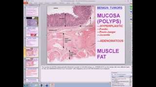 Medical School Pathology 2013 Season Session 28 GIII [upl. by Bow748]