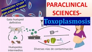 Toxoplasmosis  Parasitology [upl. by Babby]