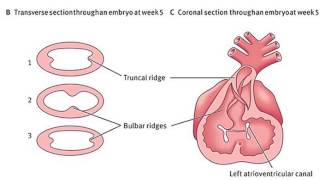 Embryology of the Heart  bulbus cordis ventricles and truncus arteriosus Dr Ahmed Farid [upl. by Ivel950]