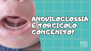 Existe relação entre anquiloglossia e torcicolo congênito RESPONDENDO PERGUNTAS [upl. by Ahsitneuq]