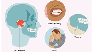 Can we ignore TMD and jaw joint and start alignersforteeth or braces [upl. by Erehc784]