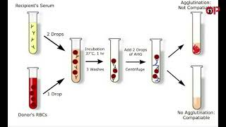 What is Cross matching its Types  procedure and interpretation [upl. by Flossi]