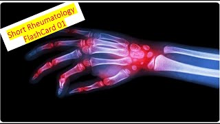 Rheumatology FlashCard 1 RS3PE English [upl. by Ailimat]