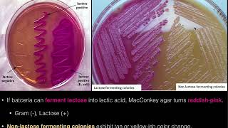 MacConkey Agar [upl. by Anujra510]