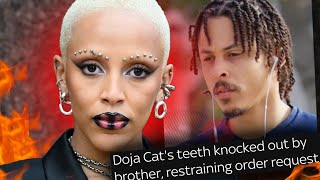 EXPOSING Doja Cats TOXIC Relationship with Her Brother He KNOCKED Her TEETH Out [upl. by Delle700]