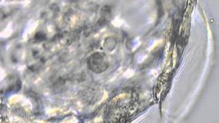 Collapsing Blastocyst prior to Cryofreezing with Vitrification [upl. by Tips]