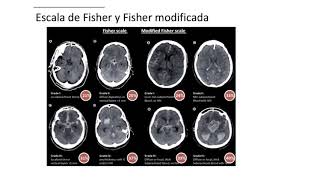 4 ACV Esc Fono FCM UNC [upl. by Yaresed]