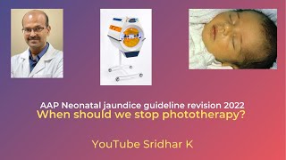 When should we stop phototherapy in babies on treatment phototherapy neonataljaundice [upl. by Notnert]