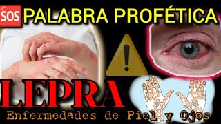 🚨🆘️ URGENTE DIOS DICE VIENE MUCHA LEPRA ENFERMEDAD DE PIEL Y OJOS MAYO 20242025 🆘️🚨 [upl. by Eliott]