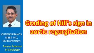 Grading of Hills sign in aortic regurgitation [upl. by Janot]