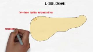 Pancreatitis aguda en 6 minutos [upl. by Addie]