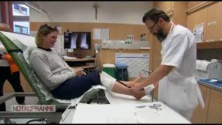 DYR 146 broken ankle snowboarding cast slc 1 [upl. by Sivad]