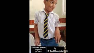 Dystonia Generalized Dystonia patient video amp its DetailDr Bilal khanzada Consultant Neurologist [upl. by Ahgiela584]