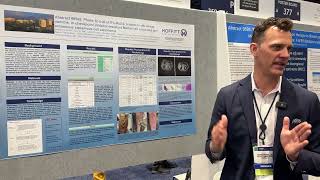 Andrew Brohl at ASCO 2024  Abstract 9592 [upl. by Sara412]