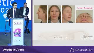 Dr Ahmad Paper Presentation at Aesthetic Meeting Apr 2023 [upl. by Tirrag523]