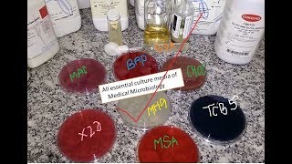 All essential culture media of Medical Microbiology Practical demo from a single table [upl. by Adnohral]