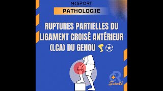 Rupture Partielle du LCA  Comprendre Diagnostiquer et Traiter LCA Kinésithérapie [upl. by Inatsed]