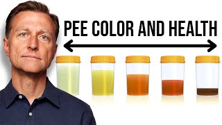 What Your URINE COLOR Says about Your Health [upl. by Necaj]