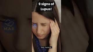 Dont ignore these 9 signs of Lupus shorts lupus [upl. by Bohman459]