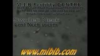 bent amp swollen neck spermabnormal sperm morphology abnormal sperm video [upl. by Vanden]