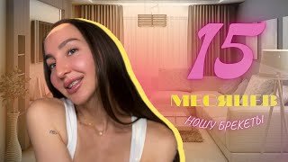 15 МЕСЯЦЕВ НОШУ БРЕКЕТЫ зубы снова кривые💁🏽‍♀️ [upl. by Akessej]