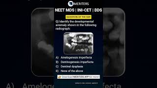 NEET MDS  INICET MDS  PSC  BDS  Most Important Questions neetmds2025 mdsprep [upl. by Adlin381]