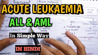 Acute Leukaemia  Acute Lymphoblastic Leukaemia ALL and Acute Myeloid Leukaemia AML  In hindi [upl. by Ydahs]