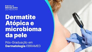 Aula 1 Dermatologia  Dermatite Atópica e microbioma da pele [upl. by Leissam]