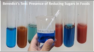 BENEDICTS TEST Presence of Reducing Sugars in Foods [upl. by Ihab]