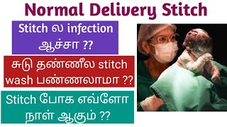 Episiotomy stitch cure tips tamil [upl. by Alexa]