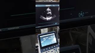 Ge Vivid S70 latest Echo gyne obs ultrasound echo [upl. by Woodford]