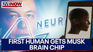 Elon Musks Neuralink implants brain chip in first human ‘results promising’ says Musk  Oneindia [upl. by Ivanna272]